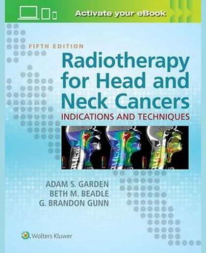 Radiotherapy for Head and Neck Cancers