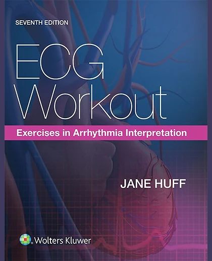 ECG Workout: Exercises in Arrhythmia Interpretation