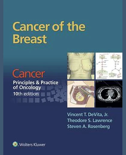 Cancer of the Breast