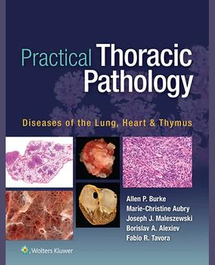Practical Thoracic Pathology