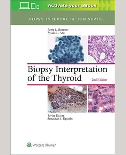 Biopsy Interpretation of the Thyroid