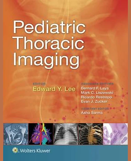 Pediatric Thoracic Imaging