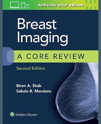 Breast Imaging: A Core Review