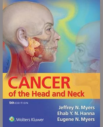Cancer of the Head and Neck