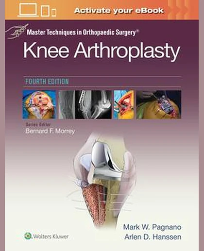 Master Techniques in Orthopedic Surgery: Knee Arthroplasty