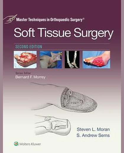 Master Techniques in Orthopaedic Surgery: Soft Tissue Surgery