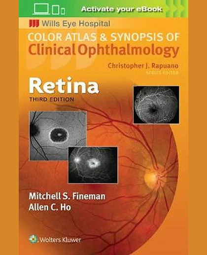 Retina