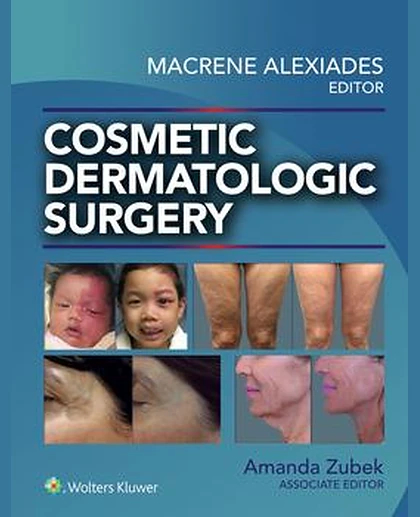 Cosmetic Dermatologic Surgery