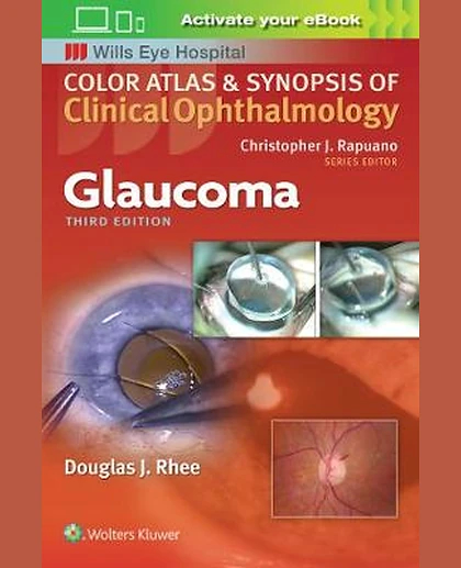 Glaucoma