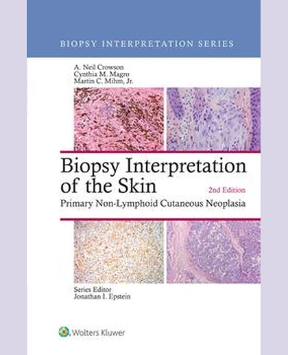 Biopsy Interpretation of the Skin
