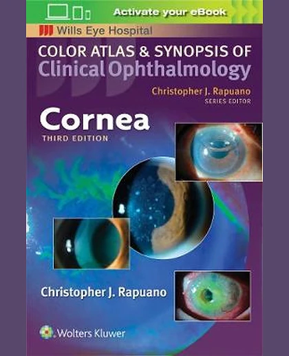 Cornea