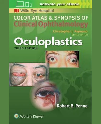 Oculoplastics
