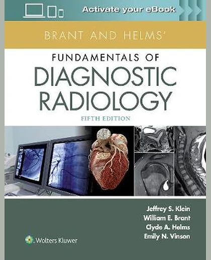 Brant and Helms' Fundamentals of Diagnostic Radiology