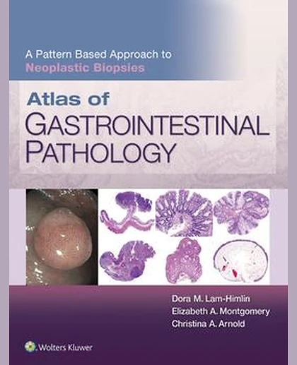 Atlas of Gastrointestinal Pathology: A Pattern Based Approach to Neoplastic Biopsies