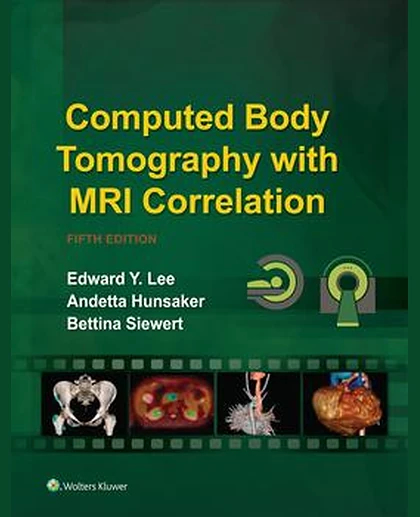 Computed Body Tomography with MRI Correlation