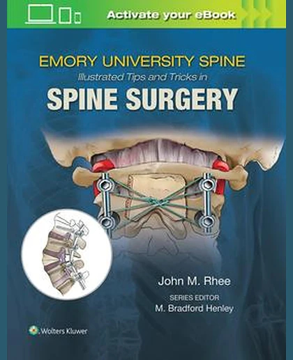 Emory's Illustrated Tips and Tricks in Spine Surgery