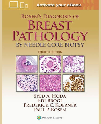 Rosen's Diagnosis of Breast Pathology by Needle Core Biopsy