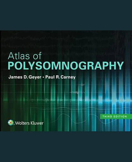 Atlas of Polysomnography