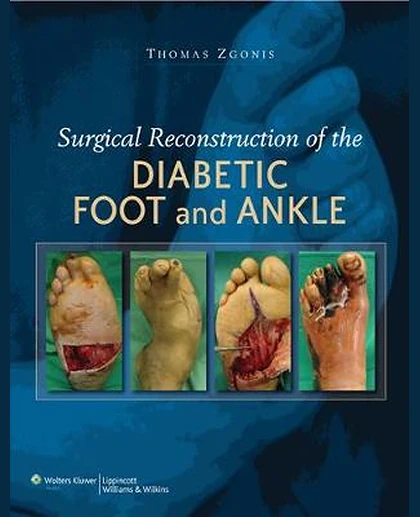 Surgical Reconstruction of the Diabetic Foot and Ankle