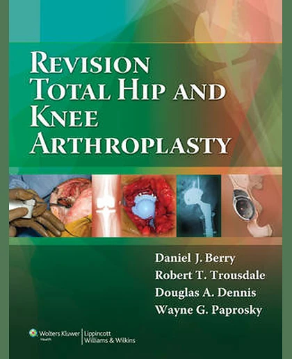 Revision Total Hip and Knee Arthroplasty