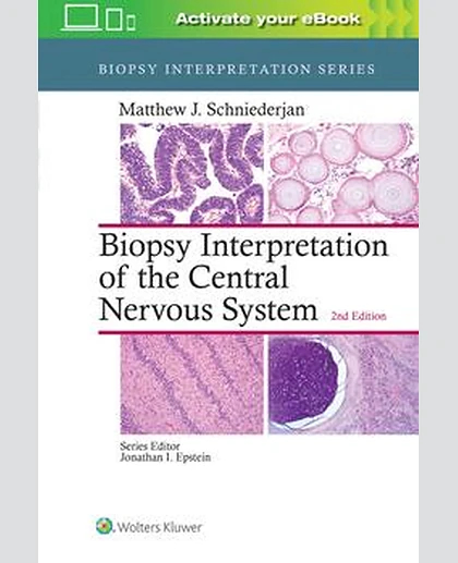 Biopsy Interpretation of the Central Nervous System