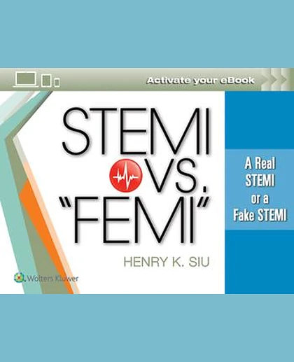 Stemi vs. Femi: The Real Deal STEMI or Fake Stemi
