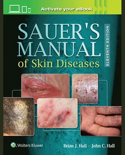 Sauer's Manual of Skin Diseases
