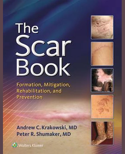 The Scar Book