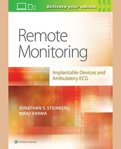 Remote Monitoring: implantable Devices and Ambulatory ECG