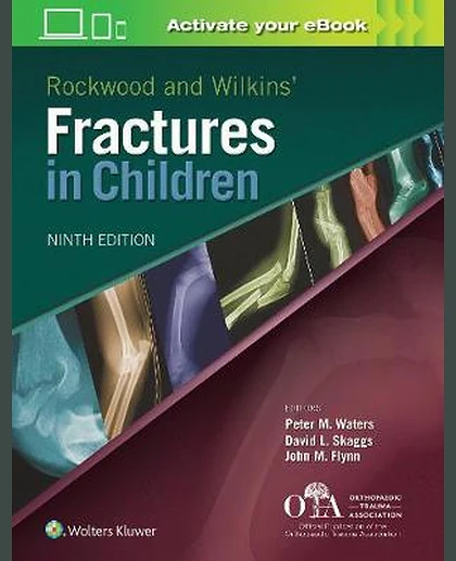 Rockwood and Wilkins' Fractures in Children