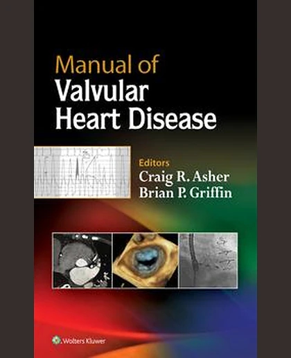 Manual of Valvular Heart Disease