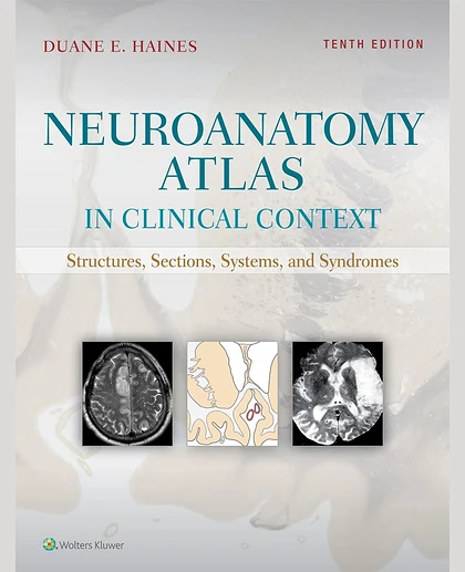Neuroanatomy Atlas in Clinical Context: Structures, Sections, Systems, and Syndromes