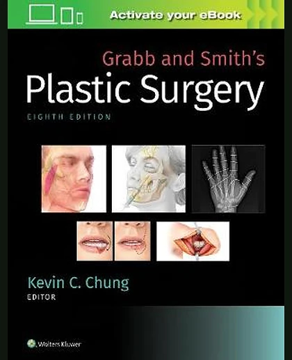 Grabb and Smith's Plastic Surgery