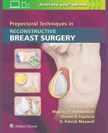 Prepectoral Techniques in Reconstructive Breast Surgery
