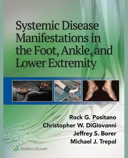 Systemic Disease Manifestations in the Foot, Ankle, and Lower Extremity