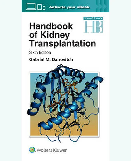 Handbook of Kidney Transplantation