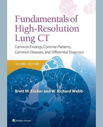 Fundamentals of High-Resolution Lung CT: Common Findings, Common Patterns, Common Diseases and Differential Diagnosis