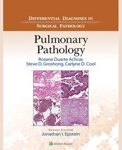 Differential Diagnoses in Surgical Pathology: Pulmonary Pathology