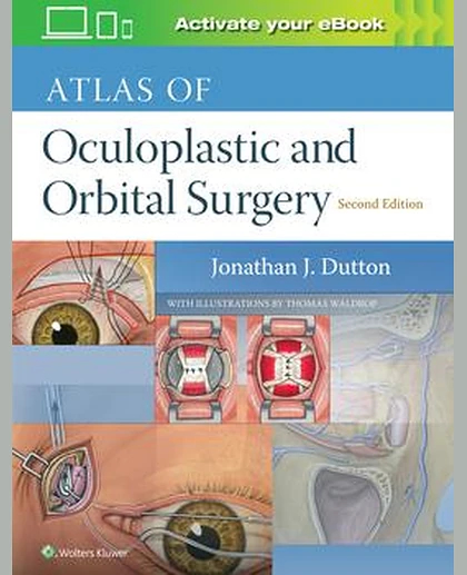 Atlas of Oculoplastic and Orbital Surgery
