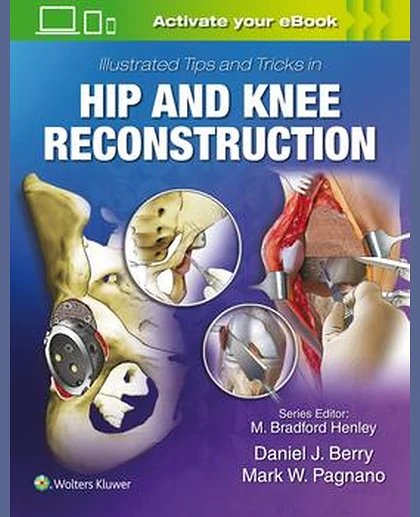 Illustrated Tips and Tricks in Hip and Knee Reconstructive and Replacement Surgery