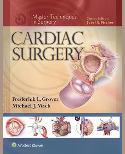 Cardiac Surgery