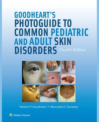 Goodheart's Photoguide to Common Pediatric and Adult Skin Disorders