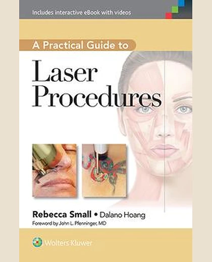 A Practical Guide to Laser Procedures