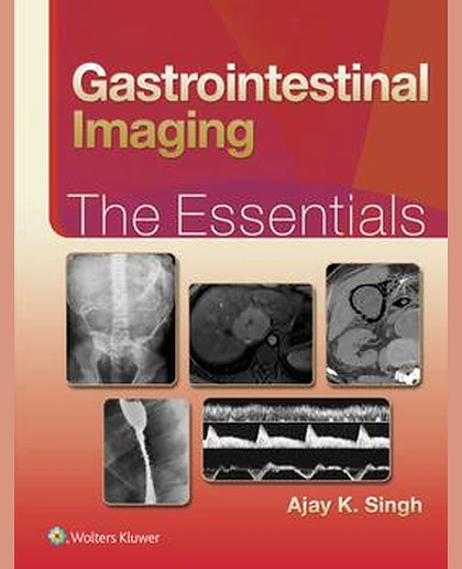 Gastrointestinal Imaging: The Essentials