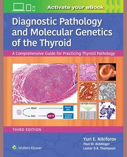 Diagnostic Pathology and Molecular Genetics of the Thyroid
