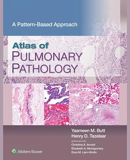 Atlas of Pulmonary Pathology