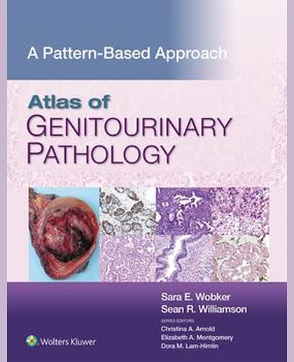 Atlas of Genitourinary Pathology