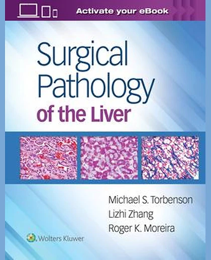 Surgical Pathology of the Liver