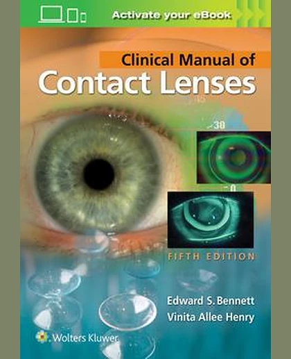 Clinical Manual of Contact Lenses