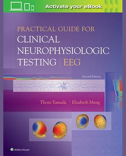 Practical Guide for Clinical Neurophysiologic Testing: EEG